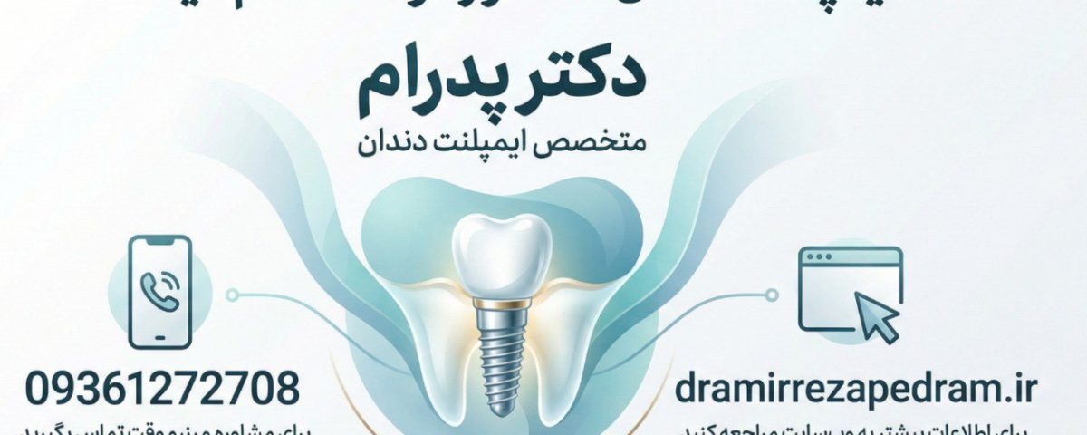 قیمت ایمپلنت دندان با اقساط سالیانه و ویژه