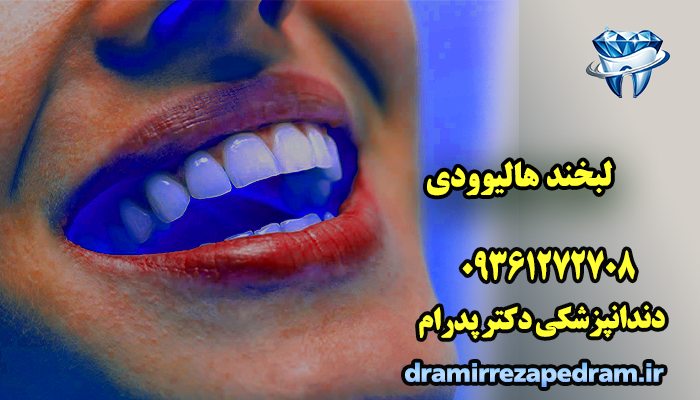 لبخند هالیوودی