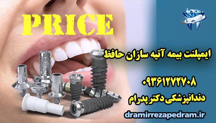 ایمپلنت بیمه آتیه سازان حافظ
