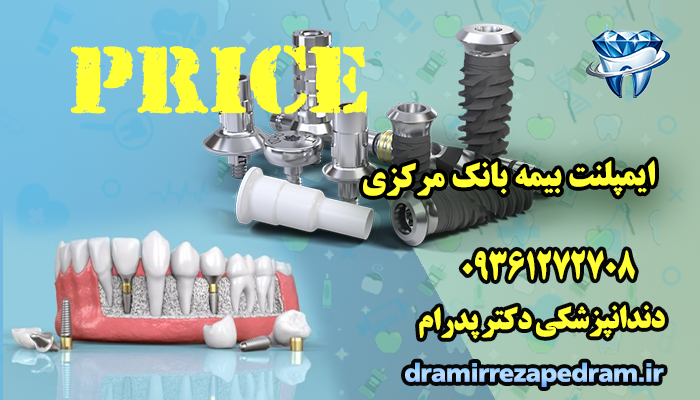 ایمپلنت بیمه بانک مرکزی