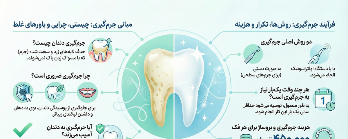 جرم گیری دندان