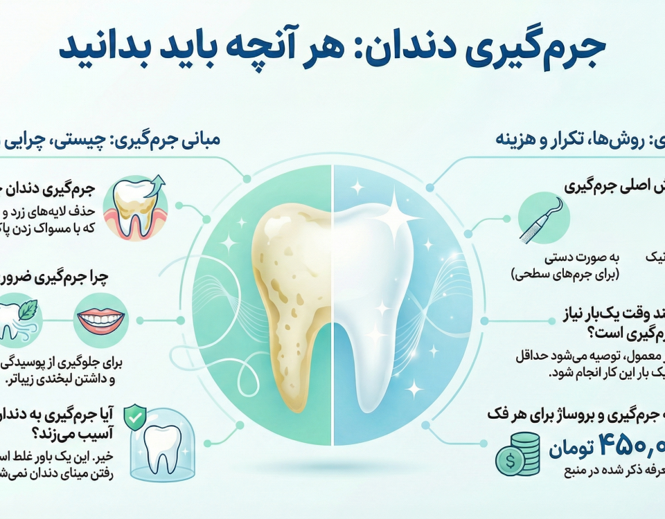 جرم گیری دندان