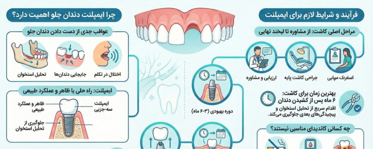 ایمپلنت دندان جلو