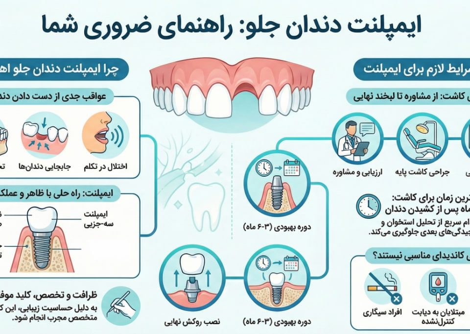 ایمپلنت دندان جلو