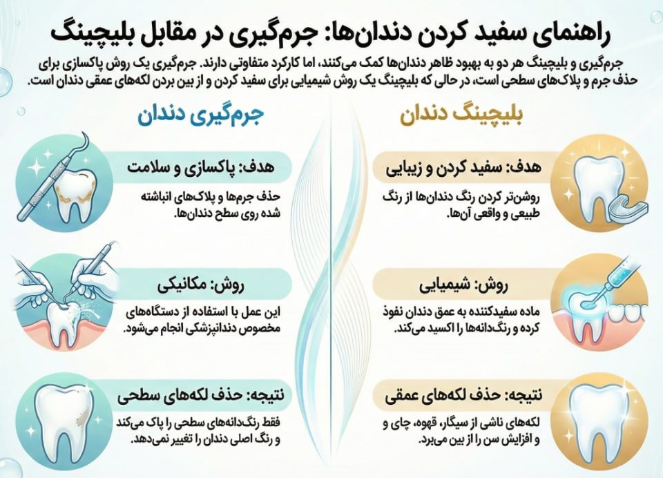 تفاوت بلیچینگ و جرم گیری دندان