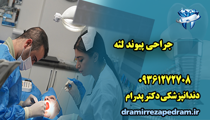 جراحی پیوند لثه