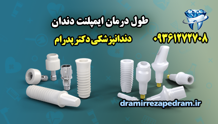 طول درمان ایمپلنت دندان