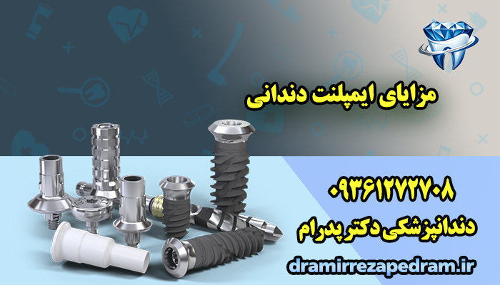 مزایای ایمپلنت دندانی