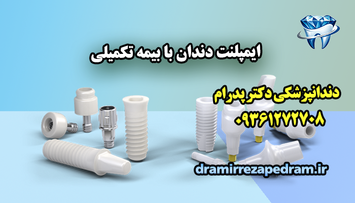 ایمپلنت دندان با بیمه تکمیلی