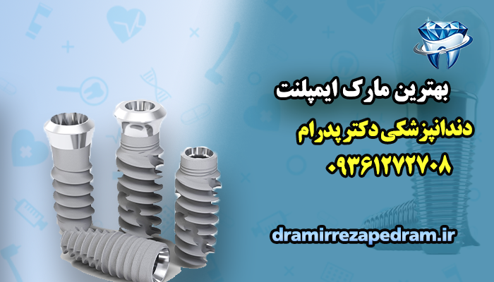 بهترین مارک ایمپلنت