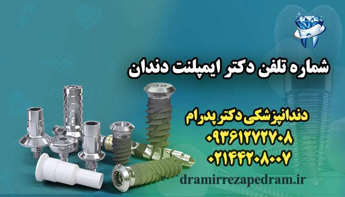 شماره تلفن دکتر ایمپلنت دندان