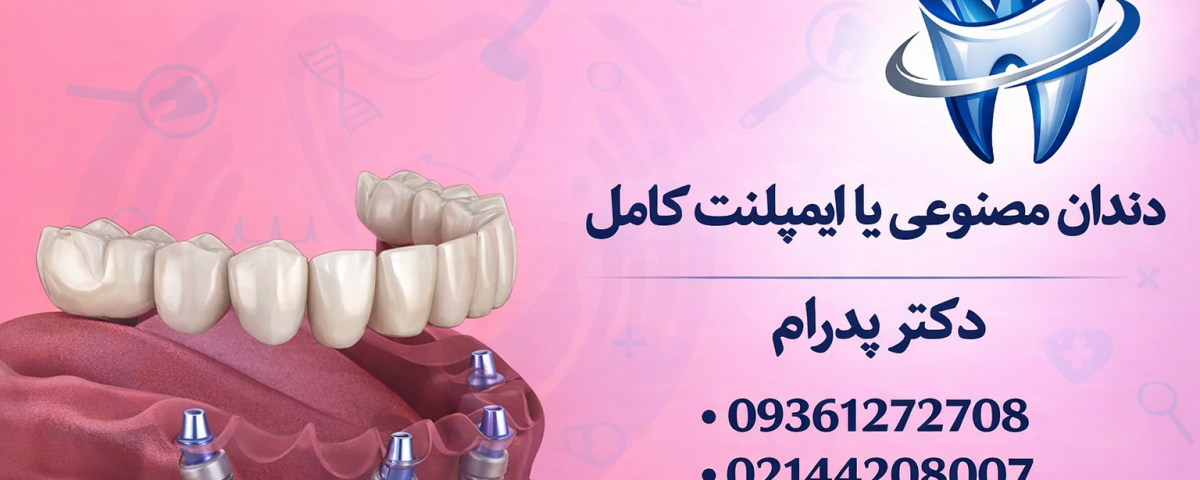 دندان مصنوعی یا ایمپلنت کامل