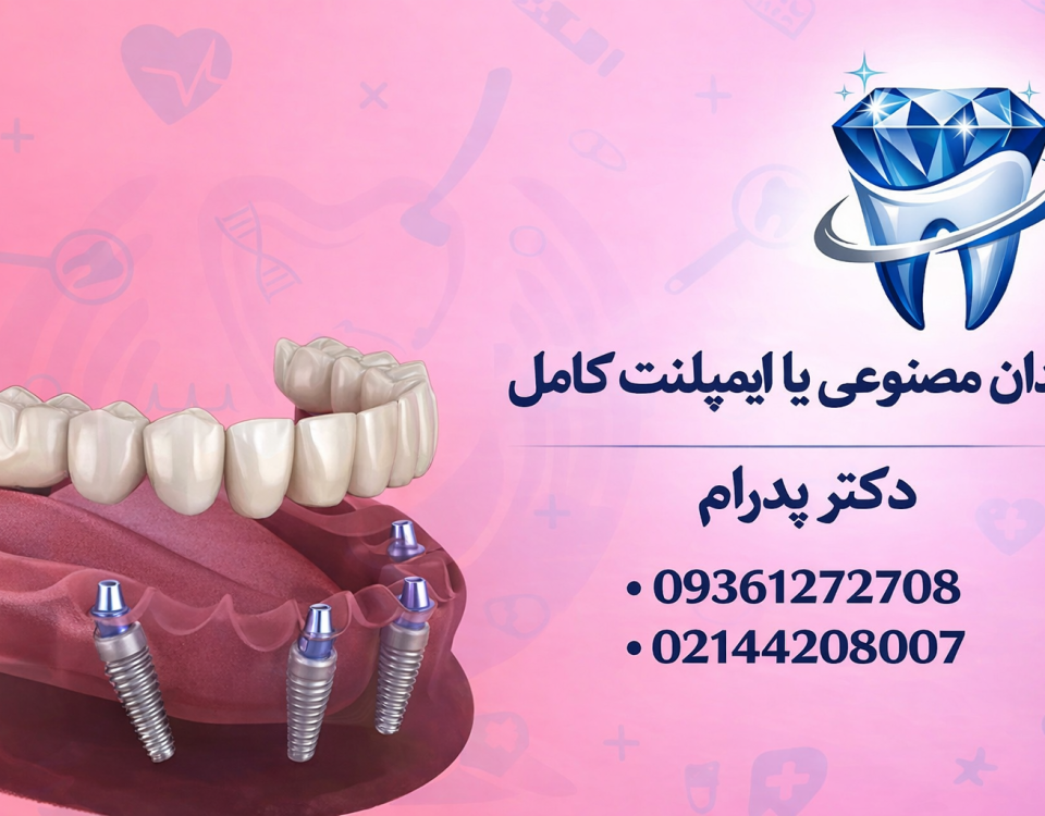 دندان مصنوعی یا ایمپلنت کامل