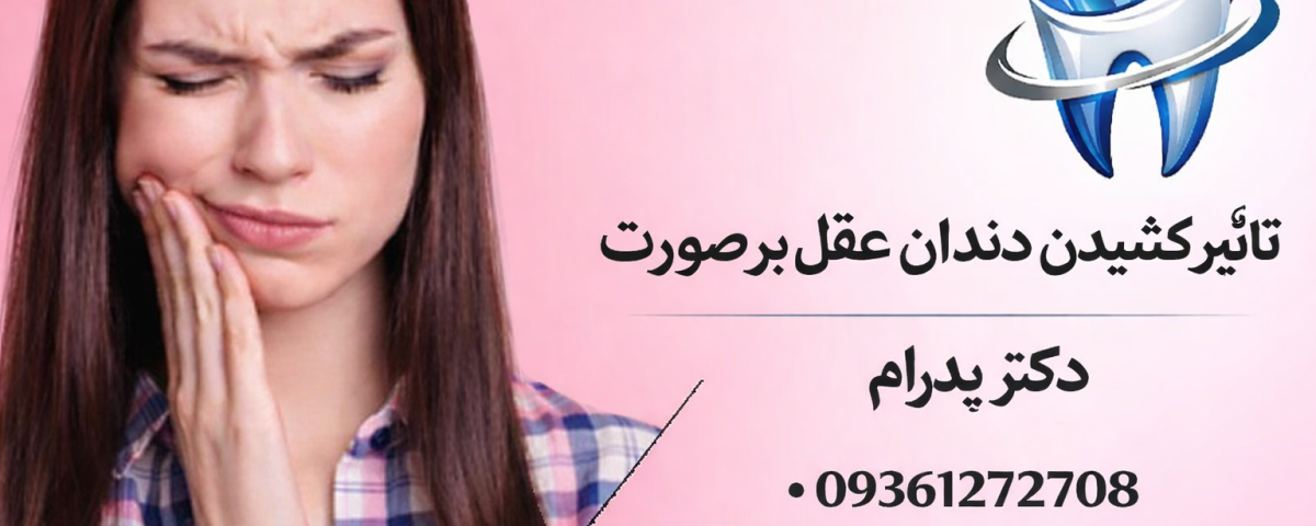 تاثیر کشیدن دندان عقل بر صورت