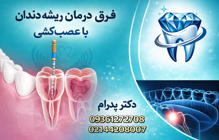 فرق درمان ریشه دندان با عصب کشی