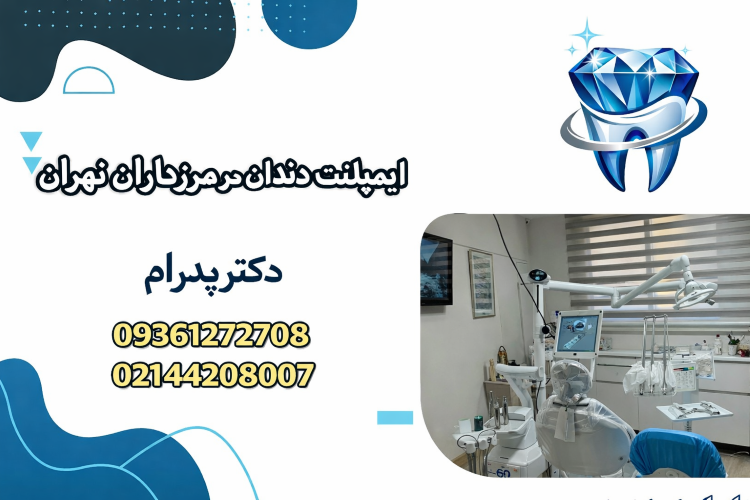 ایمپلنت دندان در مرزداران تهران