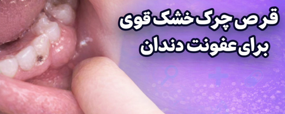 قرص چرک خشک کن قوی برای عفونت دندان