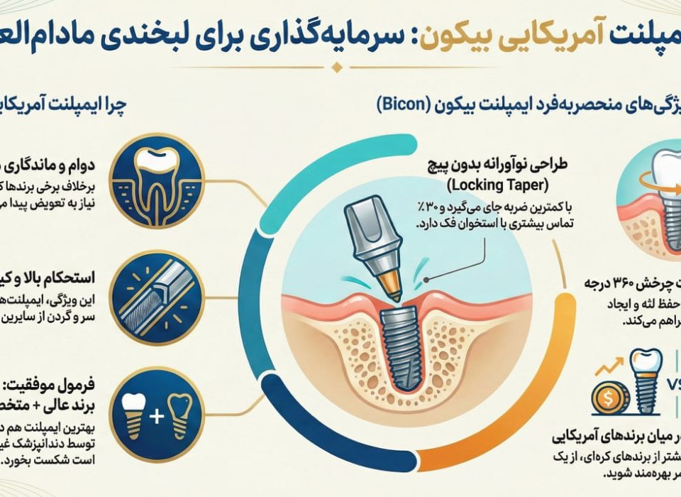 قیمت ایمپلنت آمریکایی بیکون