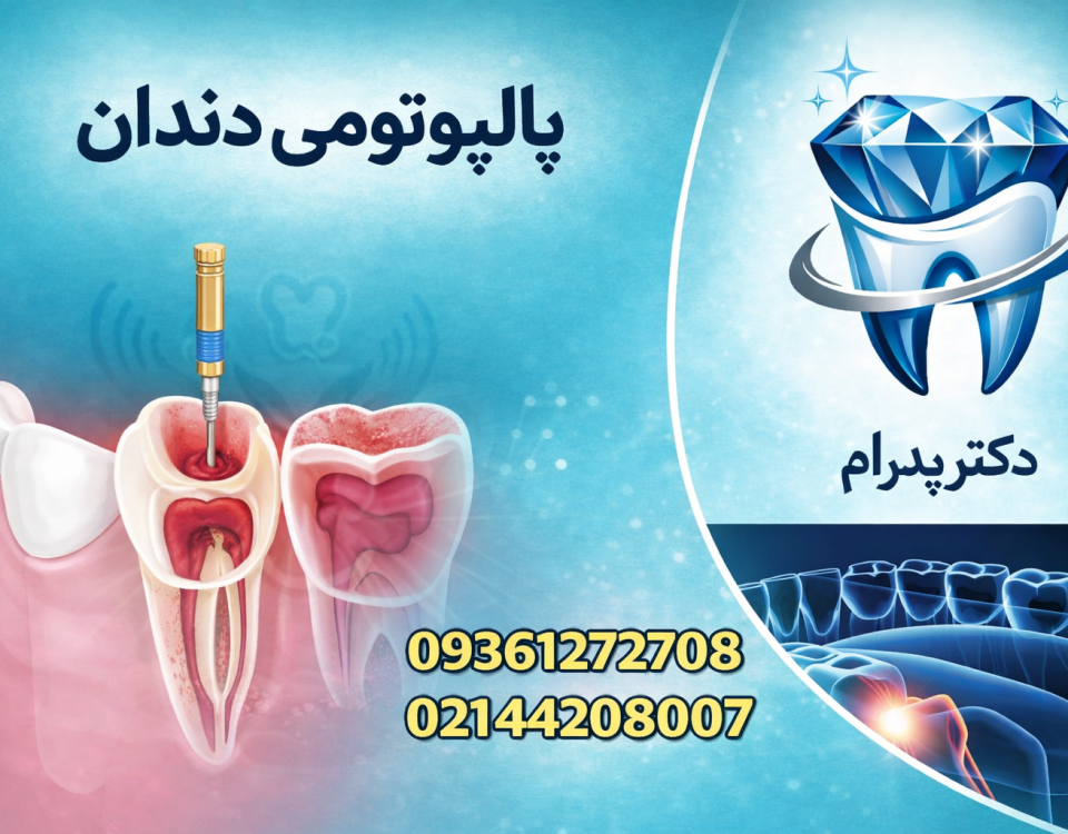 پالپوتومی دندان