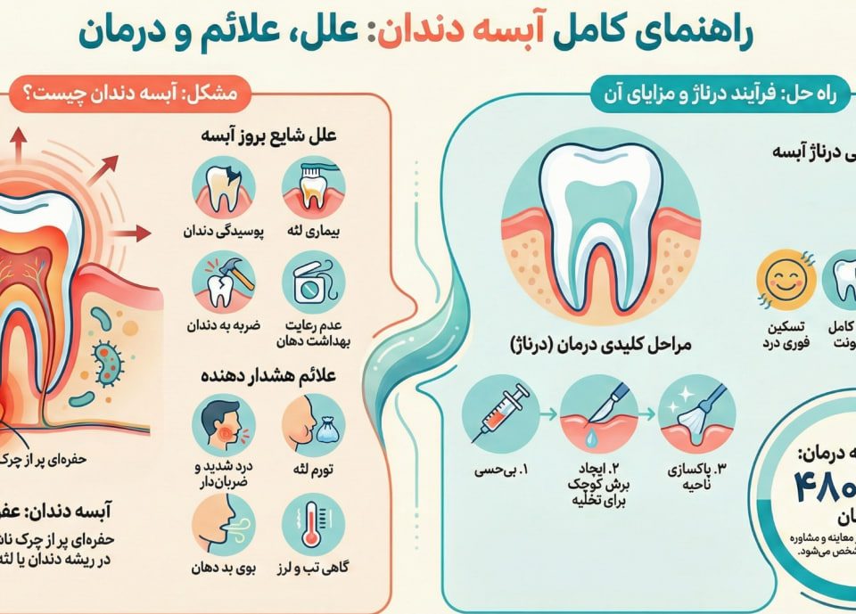 درناژ آبسه دندان