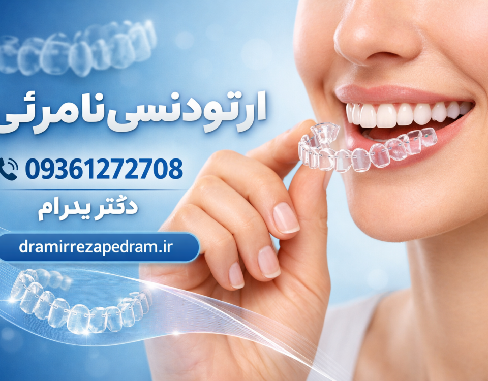 قالب گیری ارتودنسی