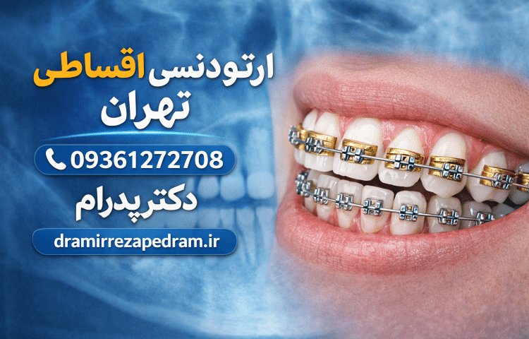 ارتودنسی اقساطی در تهران 2 ارتودنسی اقساطی در تهران