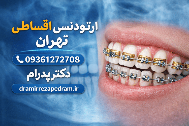 ارتودنسی اقساطی در تهران