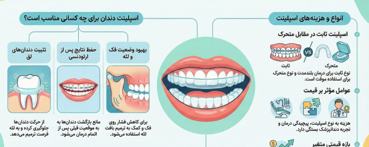 اسپلینت دندان 2 اسپیلت دندان