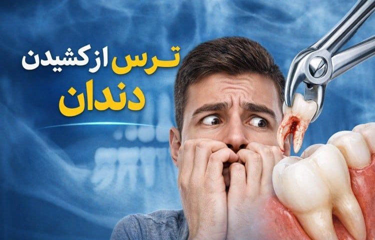 ترس از کشیدن دندان 2 ترس از کشیدن دندان