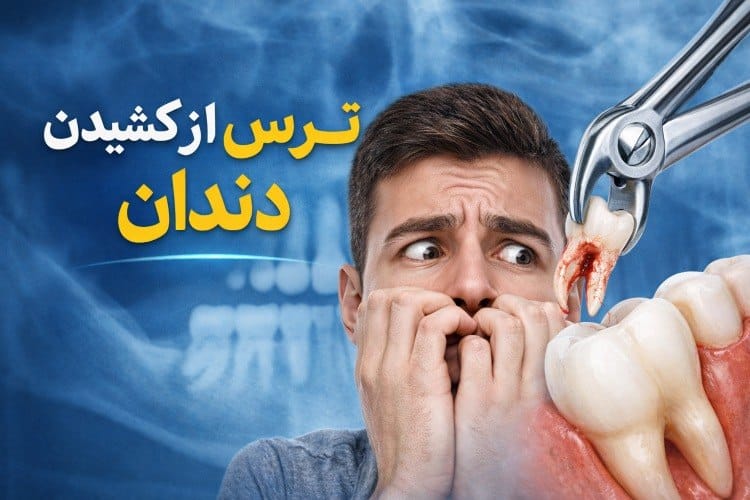 ترس از کشیدن دندان