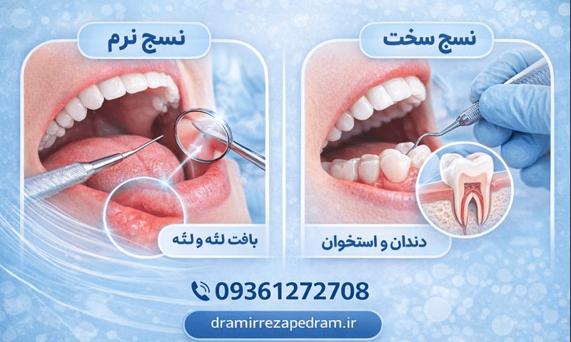 تفاوت نسج نرم و سخت