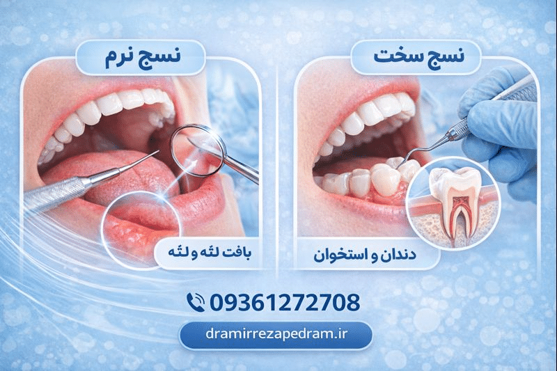 تفاوت نسج نرم و سخت