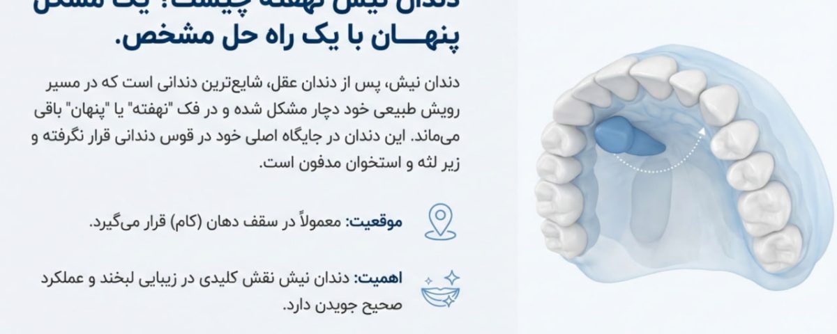 دندان نیش نهفته