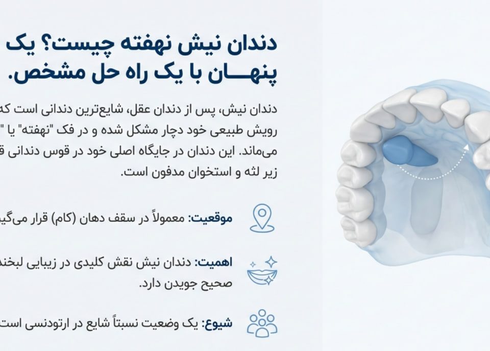دندان نیش نهفته