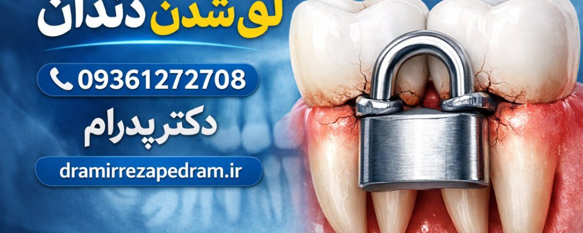 لق شدن دندان