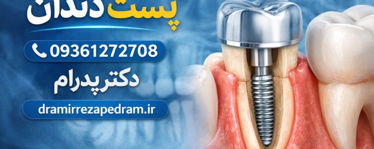 پست دندان 2 پست دندان