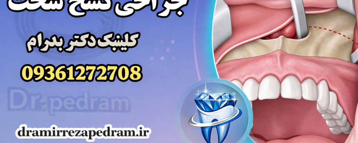 جراحی نسج سخت 2 hard nasj