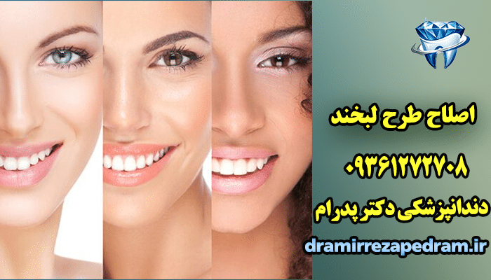 اصلاح طرح لبخند 2 اصلاح طرح لبخند