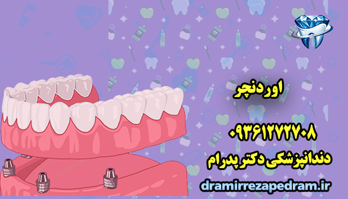 اوردنچر 2 اوردنچر