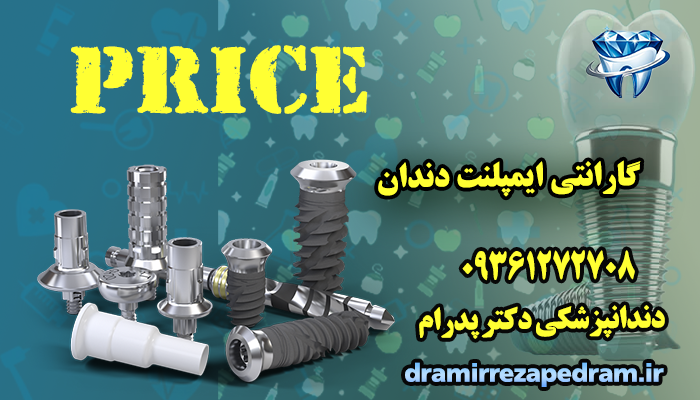 گارانتی ایمپلنت دندان