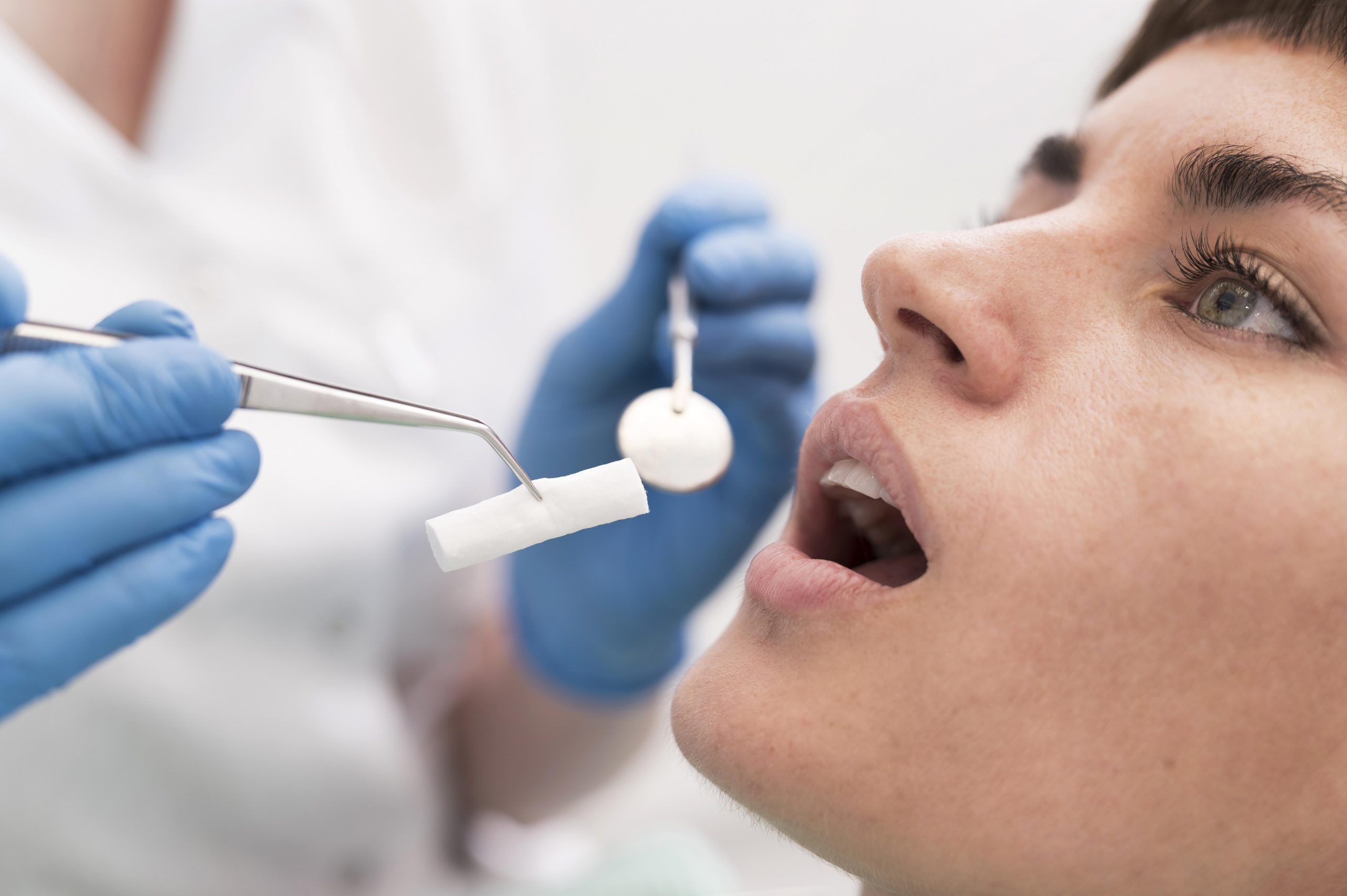 نکات مهم مراقبتهای بعد از کامپوزیت دندان 3 نکات مهم مراقبتهای بعد از کامپوزیت دندان