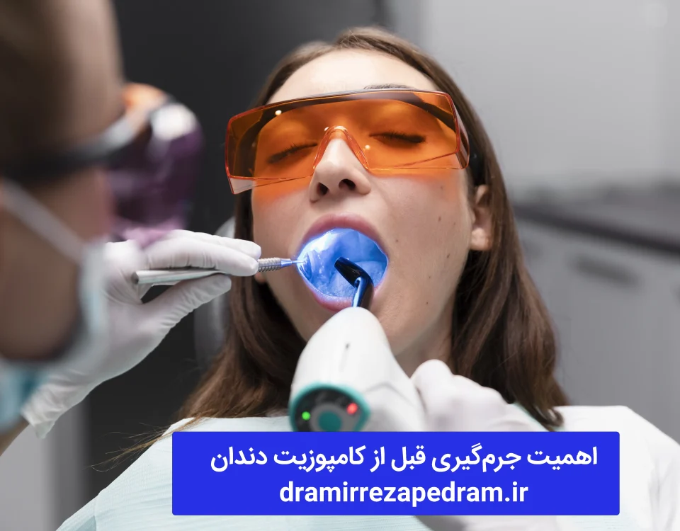 اهمیت جرم‌گیری قبل از کامپوزیت دندان