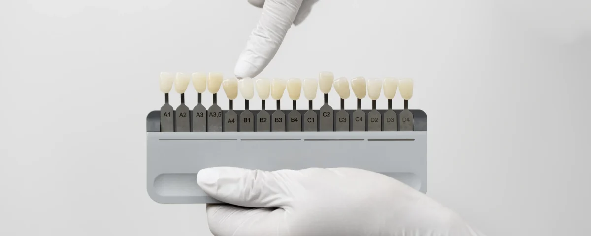 بهترین رنگ کامپوزیت دندان 2 بهترین رنگ کامپوزیت دندان