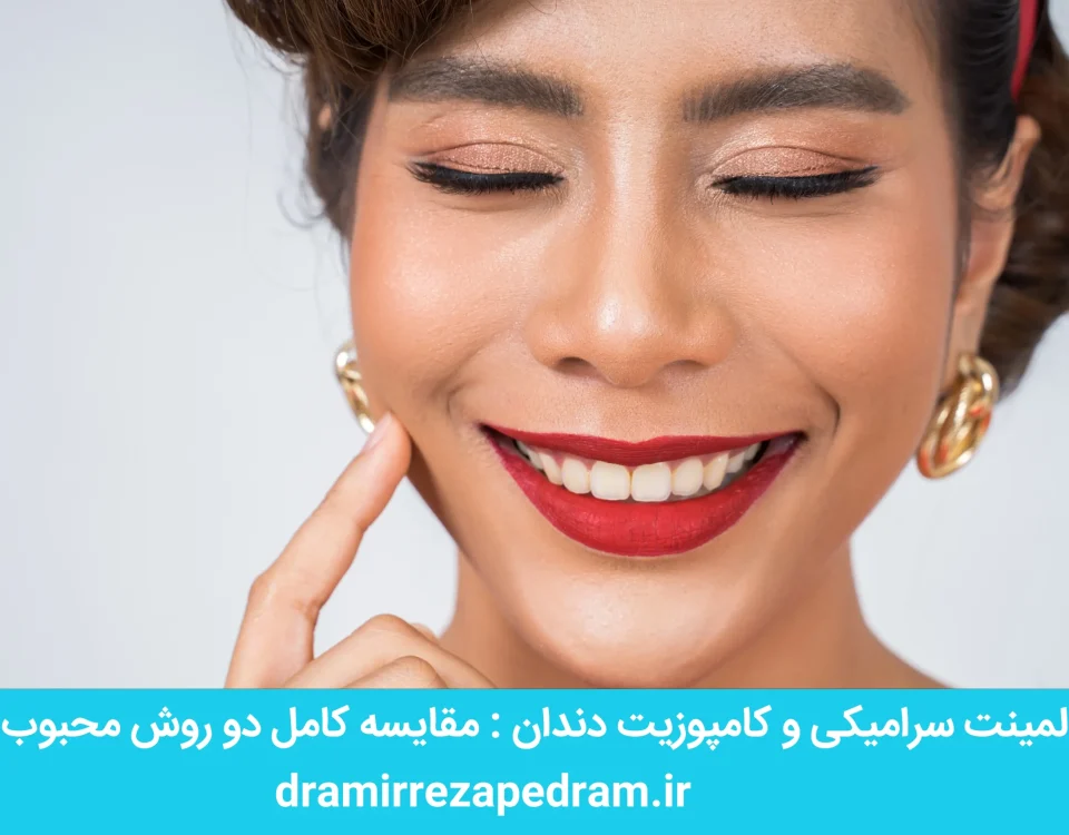 لمینت سرامیکی و کامپوزیت دندان