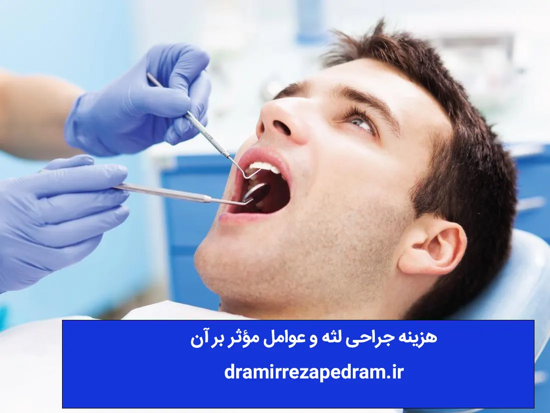 هزینه جراحی لثه و عوامل مؤثر بر آن