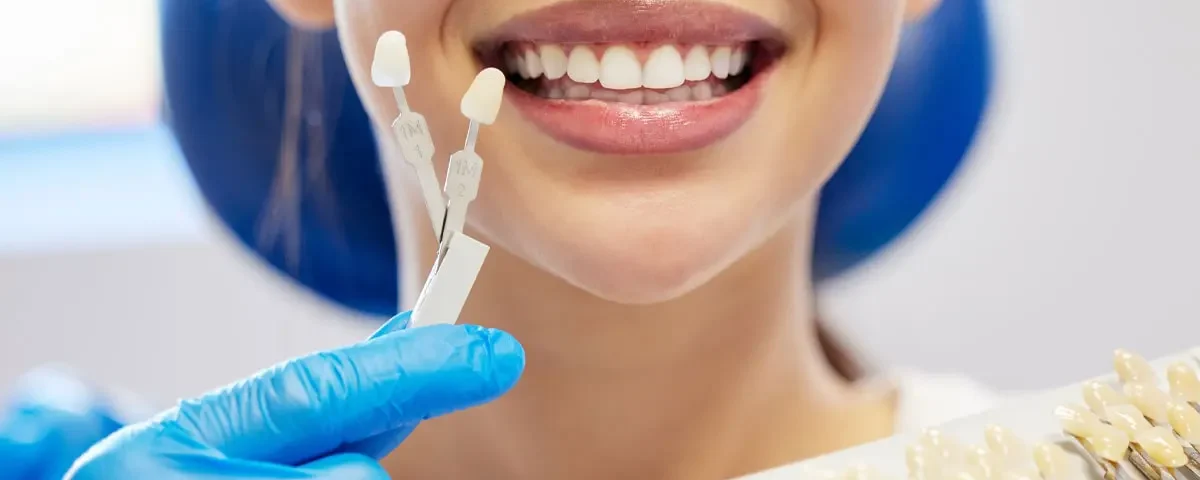 چه مواردی سبب خرابی کامپوزیت دندان می شود