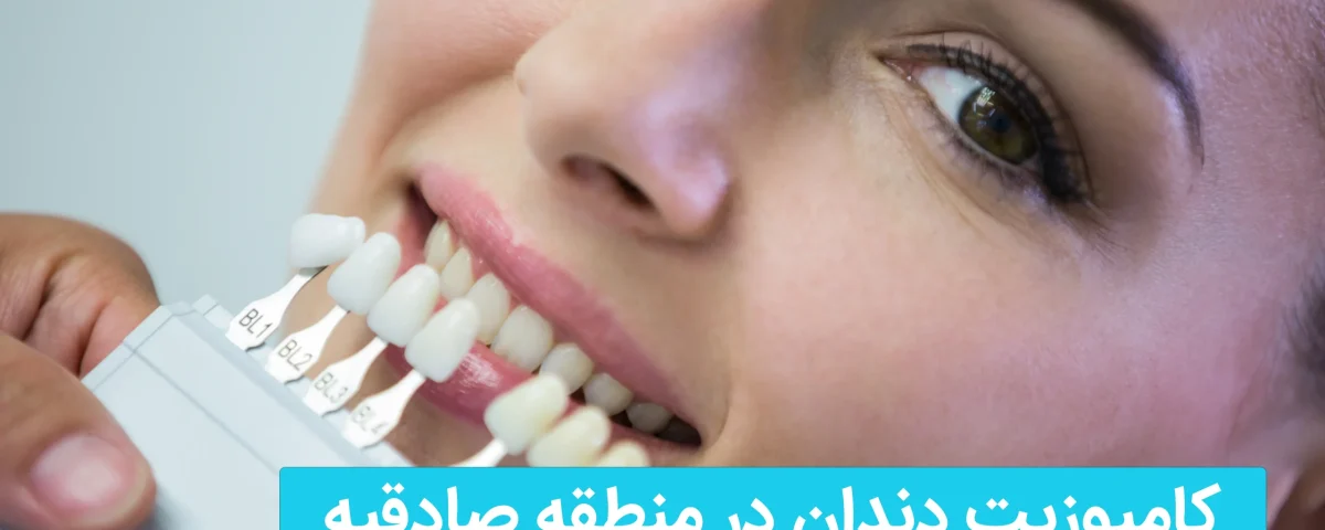 کامپوزیت دندان در منطقه صادقیه