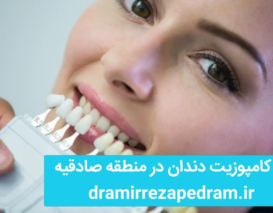 کامپوزیت دندان در منطقه صادقیه 8 کامپوزیت دندان در منطقه صادقیه
