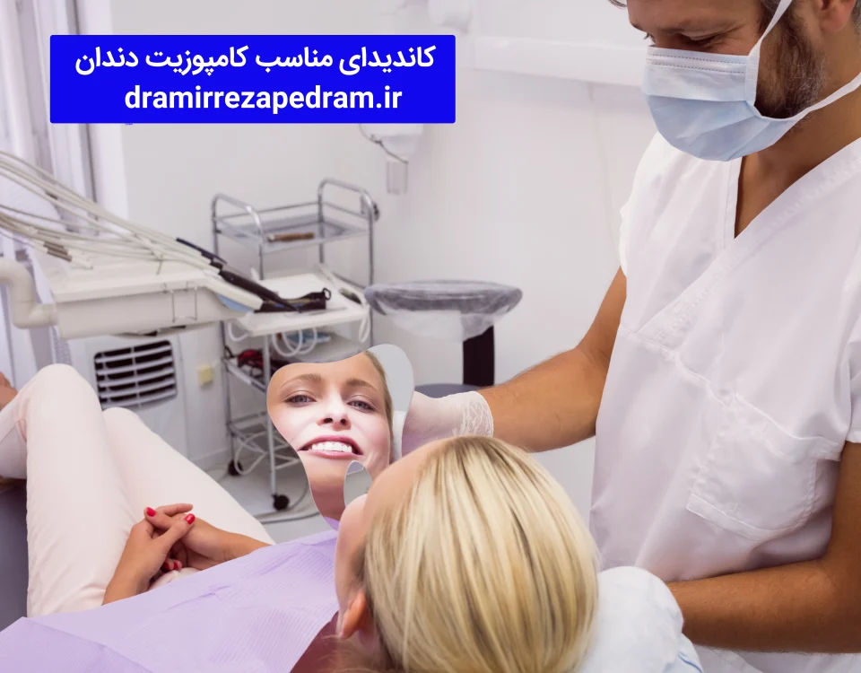 کاندیدای مناسب کامپوزیت دندان